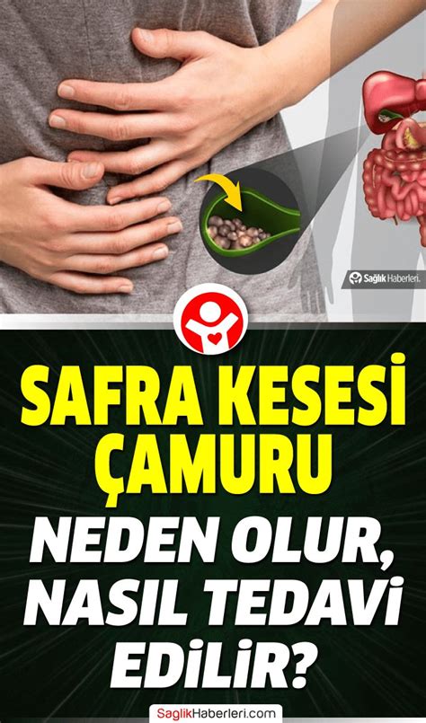 safra kesesi çamuru doğal tedavisi